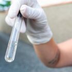 Profissional com luva segura frasco com água e mosquito