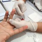 Profissional da saúde com luva realiza teste rápido em mão de outra pessoa