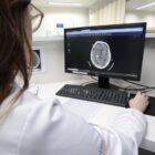 Imagem mostra mulher de cabelos longos observando tela de monitor que mostra exame de um cérebro